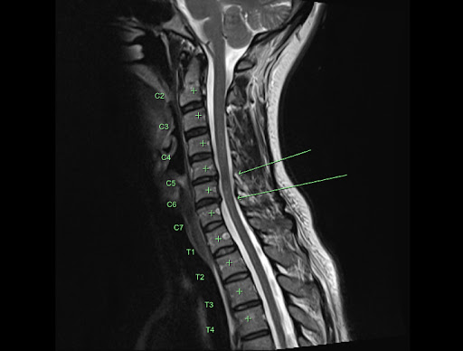 X-Ray of back